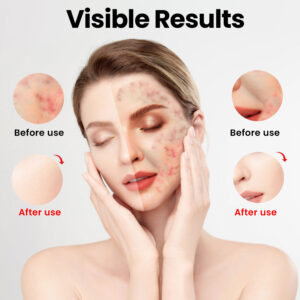 Can I Use Red Light Therapy Every Day In Australia